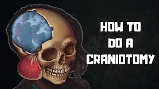 How to do a craniotomy [upl. by Rhiana]