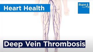 How deep vein thrombosis DVT forms  Bupa Health [upl. by Immij]