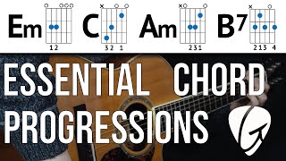 Chord Progression Practice  Em C Am B7  Beginner Guitar Lessons [upl. by Pomfrey]