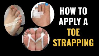 How Do I Do Toe Strapping Dislocated and Fractured Toe [upl. by Boland]