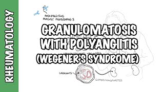 INFLAMMATION Part 9 Chronic Inflammation  GRANULOMATOUS INFLAMMATION [upl. by Erodeht797]