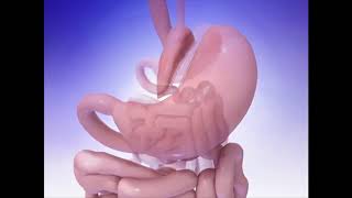 The Mini Gastric Bypass procedure Explained [upl. by Bajaj]