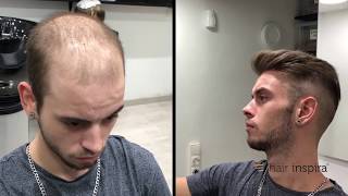 Hair Replacement fitting video David part 2 – Hair Inspira [upl. by Alial636]