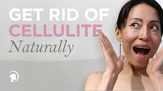 How to Get Rid of Cellulite Naturally [upl. by Taddeusz125]