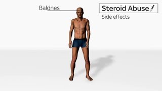 Side Effects of Steroids Abuse [upl. by Pellegrini]