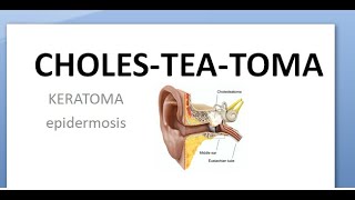 060 Cholesteatoma CSOM Atticoantral disease COM [upl. by Notgnirrab]