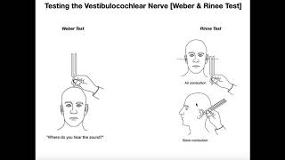 Interpreting the WeberRinne Tests EXPLAINED [upl. by Charlena]