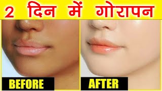 2 दिन में गोरा होने का तरीका Gharelu Nuskhe Se Gori Hone Ka Tarika जानिए गोरा होने के उपाय Fair Skin [upl. by Joellyn978]