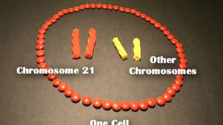 Nondisjunction Trisomy 21  An Animated Tutorial [upl. by Adnaval]