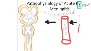 Meningitis Part 1 [upl. by Stedmann262]