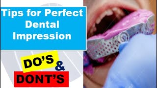 Tips for PERFECT DENTAL IMPRESSION [upl. by Arodasi]