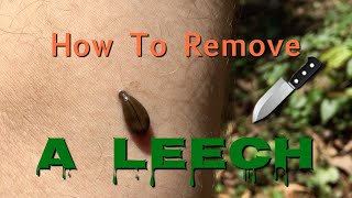 How To Remove A Leech [upl. by Darryl]