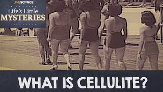 What is Cellulite [upl. by Hnilym]