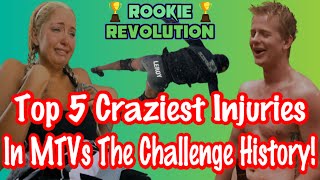 Top 5 Craziest Injuries in MTVs The Challenge History [upl. by Elvis332]