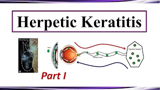 Herpetic Keratitis  Pathogenesis and Clinical Presentation Part I [upl. by Enylcaj163]