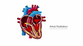 MEDICATIONS FOR HEART FAILURE CHF  NCLEX REVIEW [upl. by Fadiman]