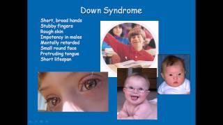 Chromosomal disorders [upl. by Eceinahs771]