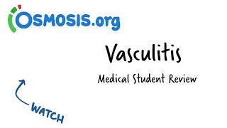 Vasculitis  Clinical Presentation [upl. by Jarnagin682]