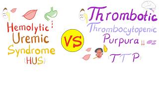 Hemolytic Uremic Syndrome HUS vs Thrombotic Thrombocytopenic purpura TTP [upl. by Chelton]