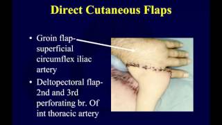 Wound coverage techniques 2  flap principles OTA lecture series III g14b [upl. by Hook433]