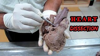 Anatomy Dissection of Heart [upl. by Bascio]