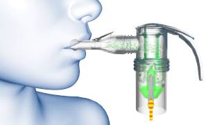 PARI LC® Nebulizer Animation [upl. by Berta403]