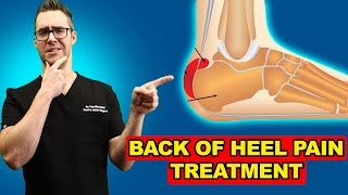 Retrocalcaneal Heel BURSITIS Treatment Heel Pain Exercises amp Massage [upl. by Lunna880]