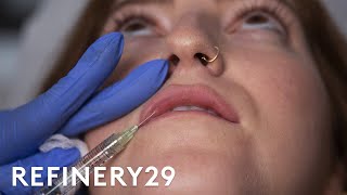 I Got Lip Filler Injections For The First Time  Macro Beauty  Refinery29 [upl. by Barthol]