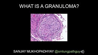 Understanding Sarcoidosis A Visual Guide for Students [upl. by Caruso]