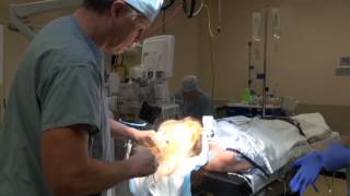 Brain Surgery with Dr Mark Matishak  04 Haircutting [upl. by Sancho]