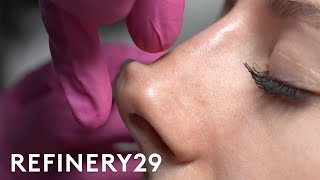 I Tried A NonSurgical Nose Job  Macro Beauty  Refinery29 [upl. by Tuddor722]