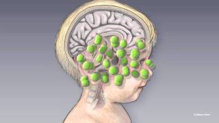 2Minute Neuroscience Meningitis [upl. by Neall]