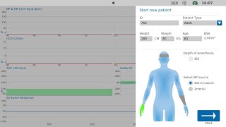 How to setup noninvasive hemodynamic monitoring  LiDCO US [upl. by Naanac153]