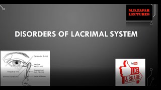 Lacrimal System Disorders [upl. by Elsa]