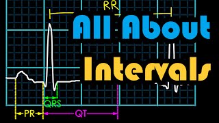 All about Intervals How to Read an EKG Curriculum [upl. by Koral143]