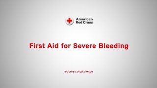 First Aid for Severe Bleeding [upl. by Aihsotan428]