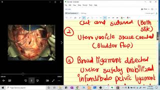 TOTAL ABDOMINAL HYSTERECTOMY  STEP BY STEP APPROACH [upl. by Nadaha503]