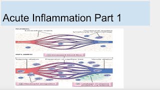 Acute Inflammation Part 1 [upl. by Adnauq]