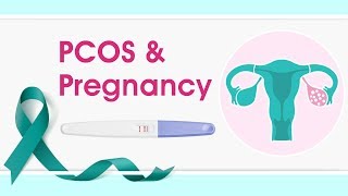 PCOS and Pregnancy [upl. by Fidole]