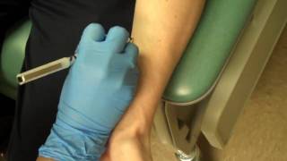 Allergy Testing Step 1 Skin Prick Testing [upl. by Atibat]