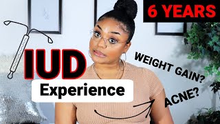 Honest IUD Experience⎜6 Years w IUD Mirena  Part 1 [upl. by Culberson]