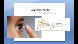 Ophthalmology 121 a AcanthAmoeba Keratitis Pseudo Dendrites eye cornea Contact lens PHMB [upl. by Wolfram]