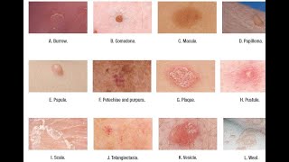 Skin Lesions with defination [upl. by Gilman]