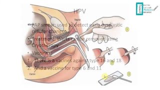 STDs Overview [upl. by Anenahs]