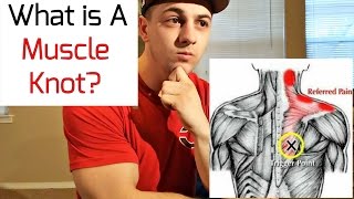 What is a Muscle Knot [upl. by Yerhcaz]